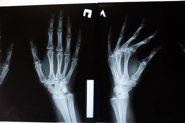 rs orthopedi di surabaya